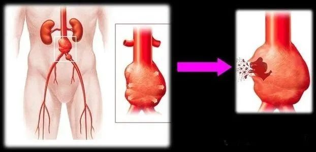 普洱市人民医院