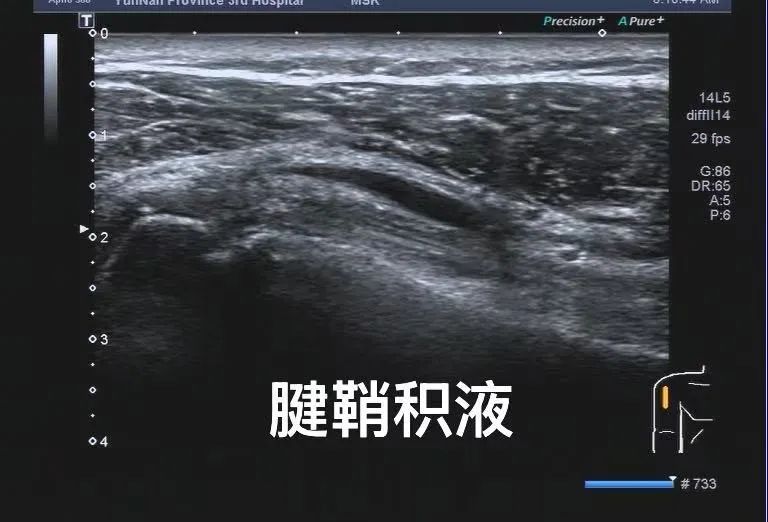 云南省第三人民医院