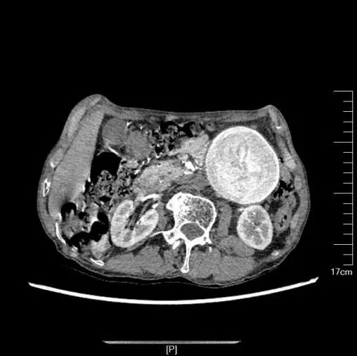 普洱市人民医院