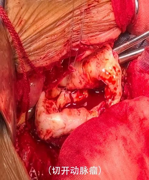 普洱市人民医院