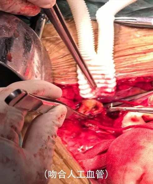 普洱市人民医院