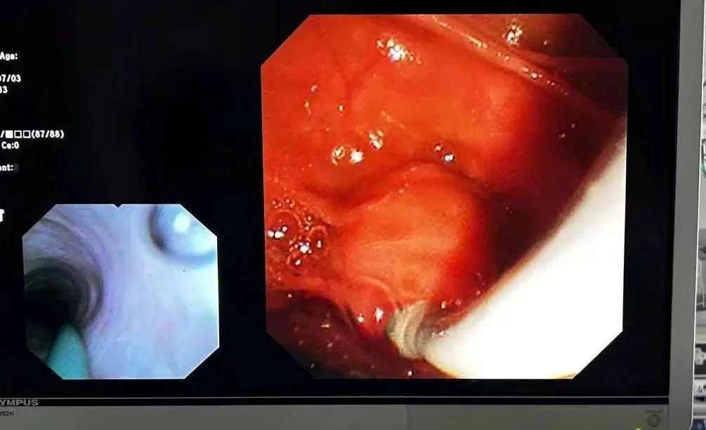 云南省第三人民医院