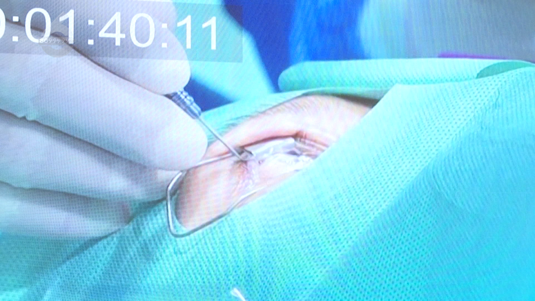 8099999街头巷尾微信