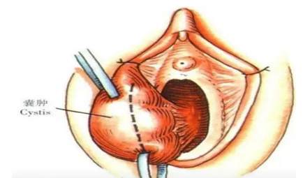 昆明市第一人民医院