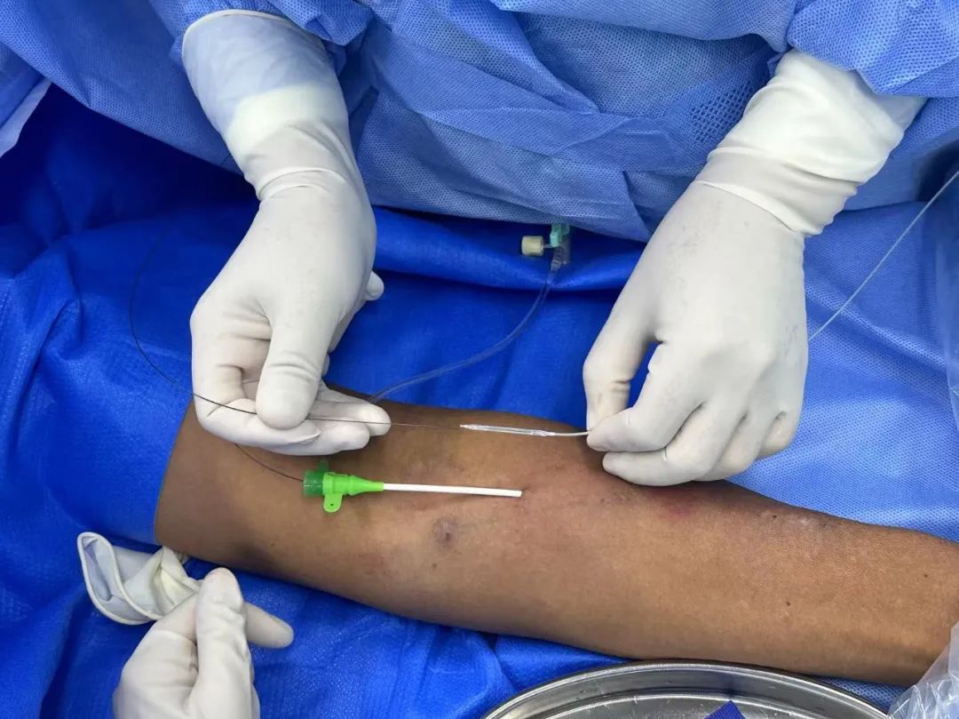 普洱市人民医院