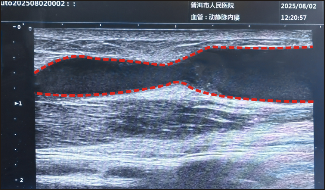 普洱市人民医院