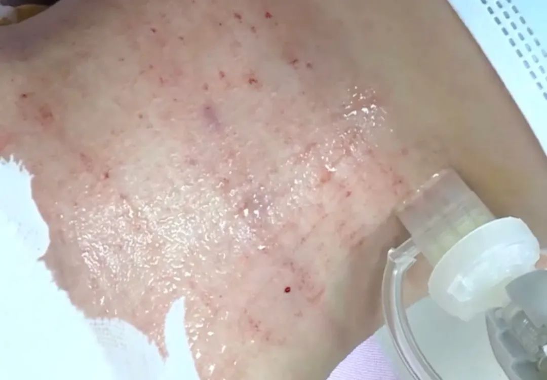 普洱市人民医院