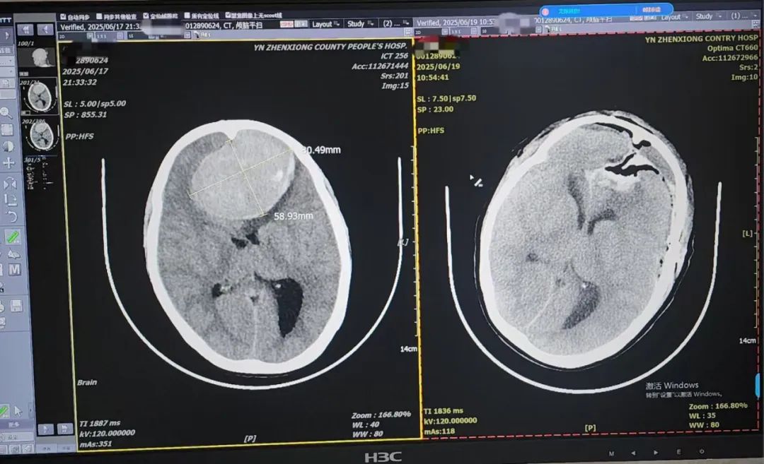 镇雄县人民医院