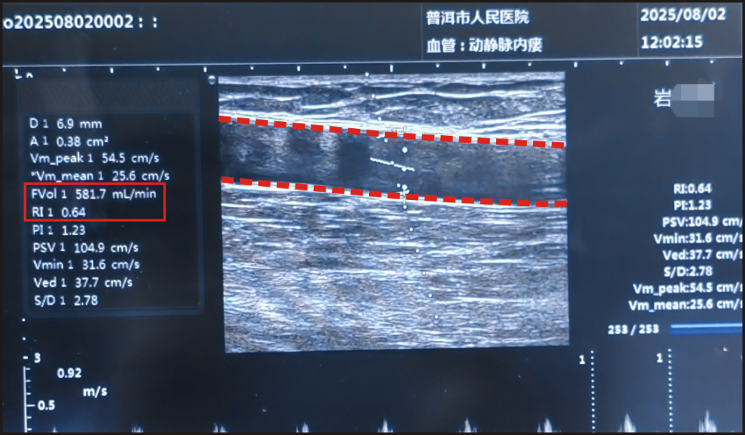 普洱市人民医院
