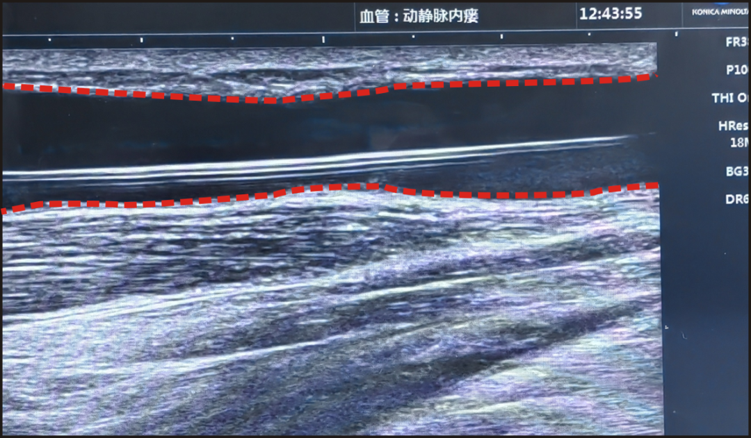 普洱市人民医院