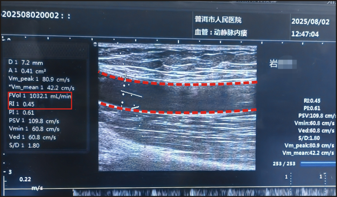 普洱市人民医院