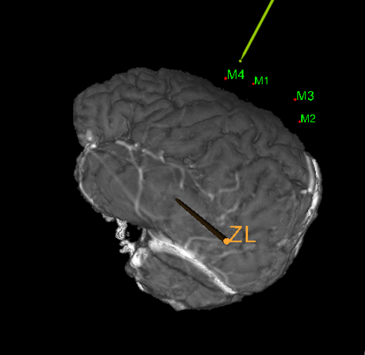 普洱市人民医院