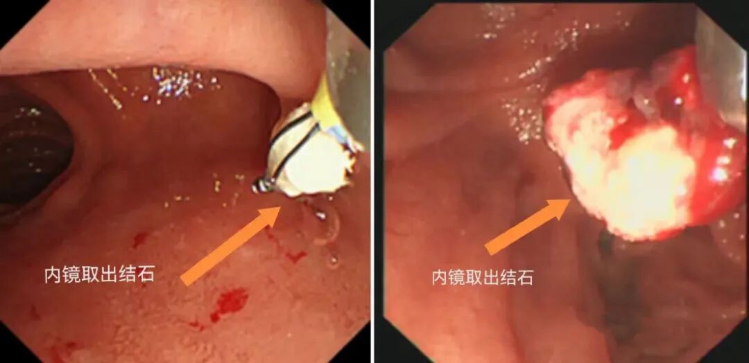 云南大学附属医院