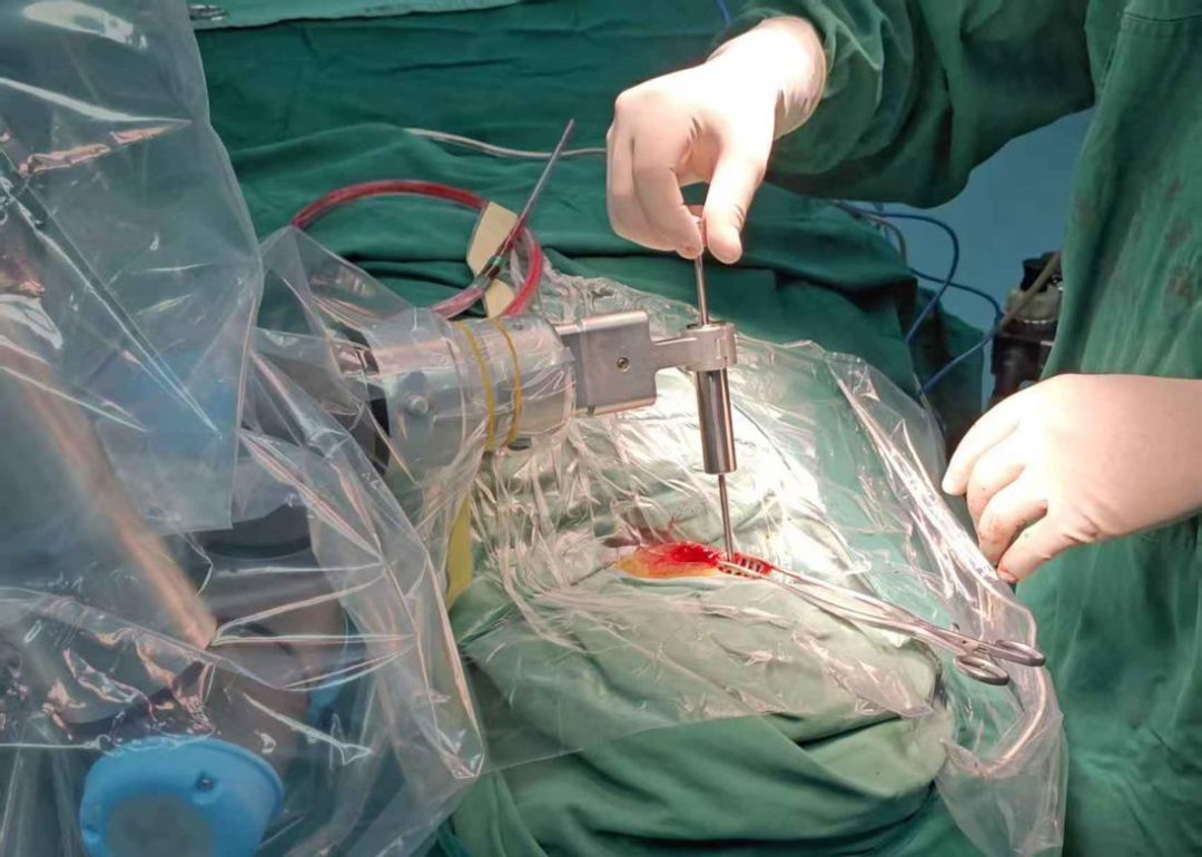 普洱市人民医院