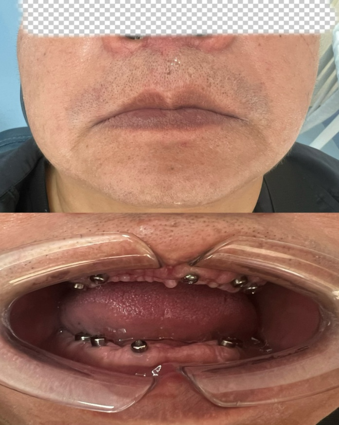 云南省保山市人民医院