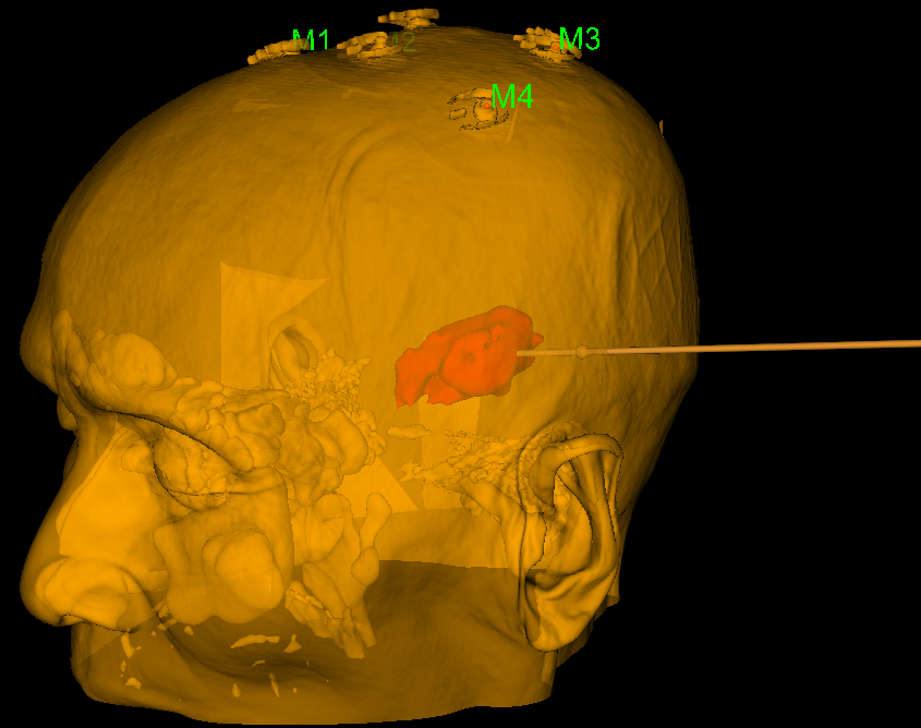 普洱市人民医院