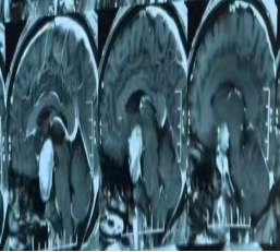 云南省传染病医院