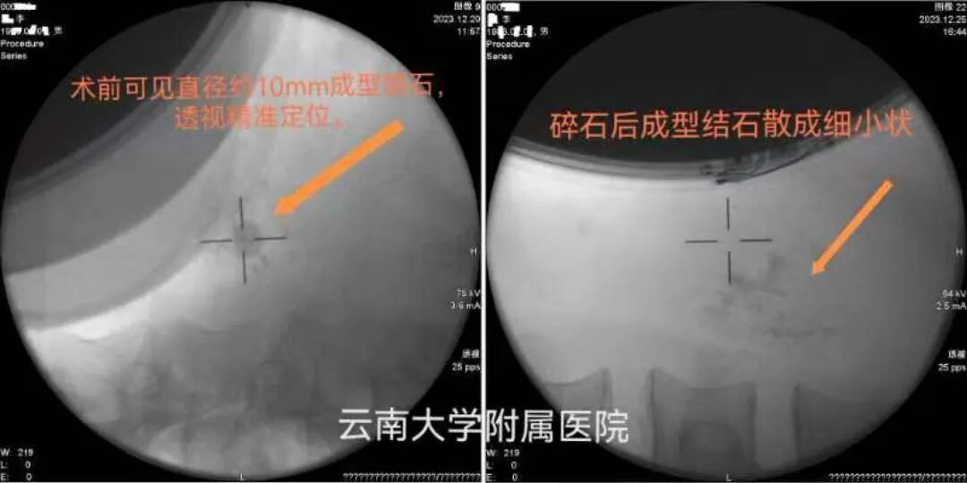 云南大学附属医院