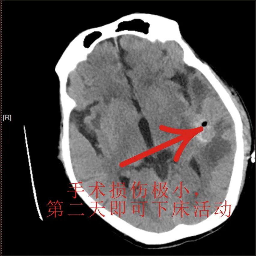 普洱市人民医院