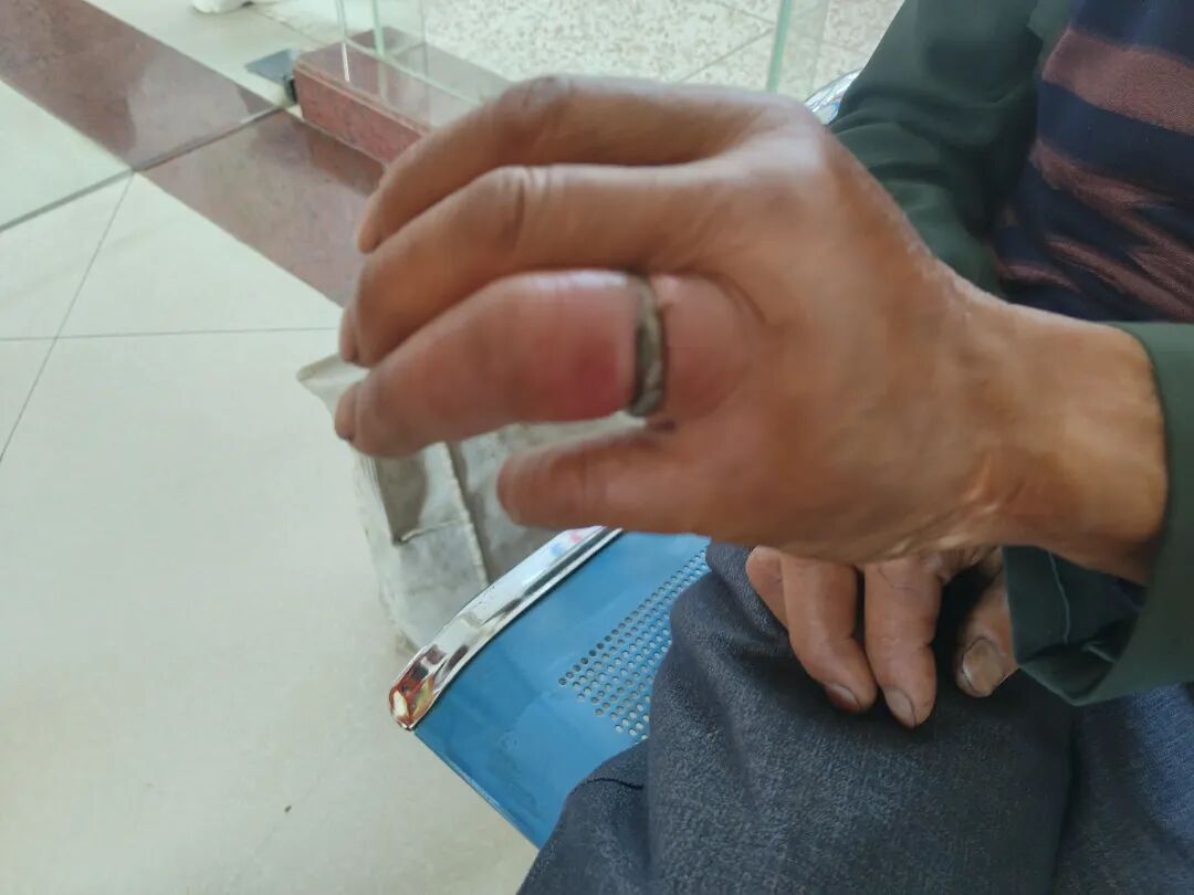 8099999街头巷尾微信