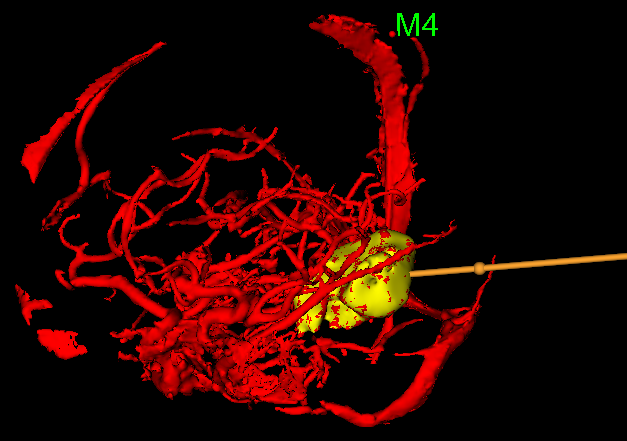 普洱市人民医院