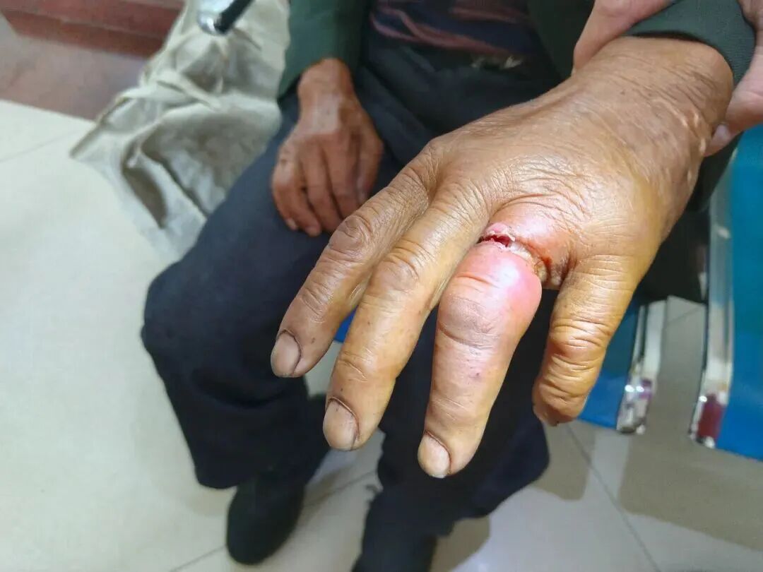 8099999街头巷尾微信